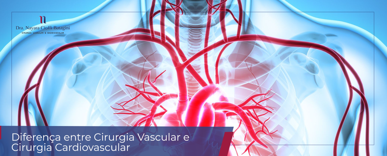 Diferença entre Cirurgia Vascular e Cirurgia Cardiovascular